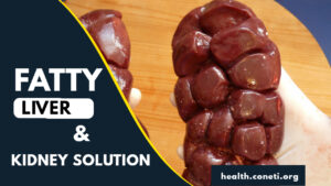 Fatty Liver & Kidney